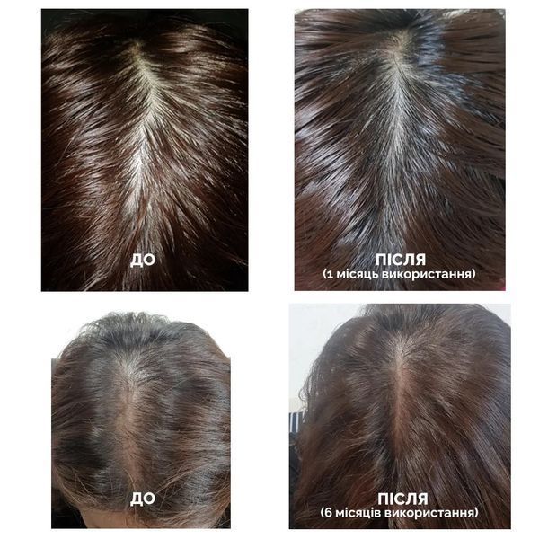 Стимулирующий тоник для роста волос Dr.FORHAIR Folligen Tonic DF880948 фото